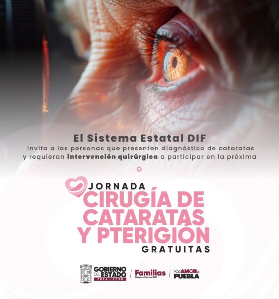 El SEDIF realizará jornada gratuita de cirugías oculares