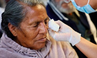 Jornada Gratuita de Cirugías de Cataratas,  transformó la vida de 500 personas de distintas regiones de Puebla