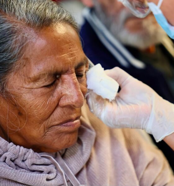 Jornada Gratuita de Cirugías de Cataratas,  transformó la vida de 500 personas de distintas regiones de Puebla
